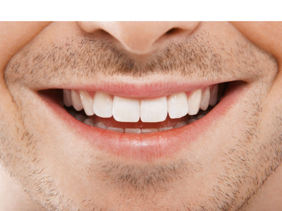 How to get whiter teeth